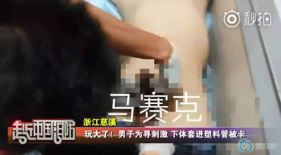 点击放大图片